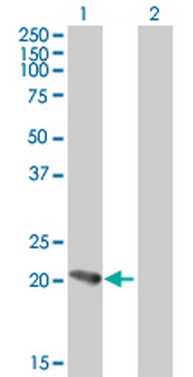 PFDN5 Antibody in Western Blot (WB)