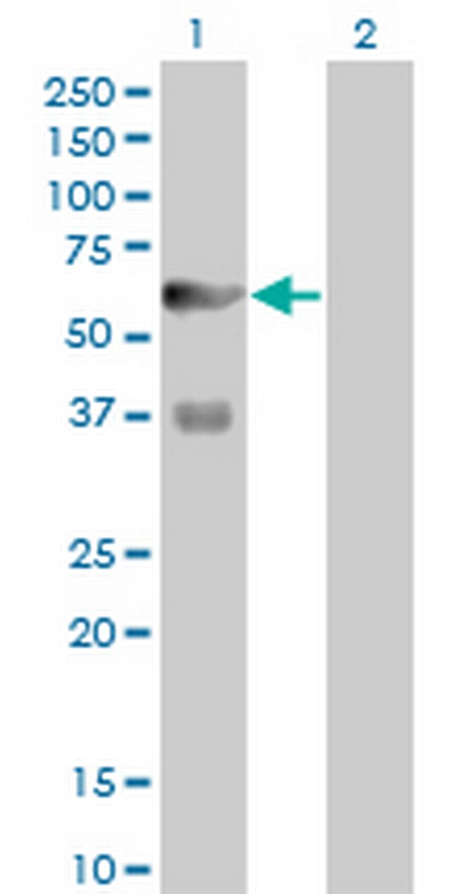 PFKFB3 Antibody in Western Blot (WB)