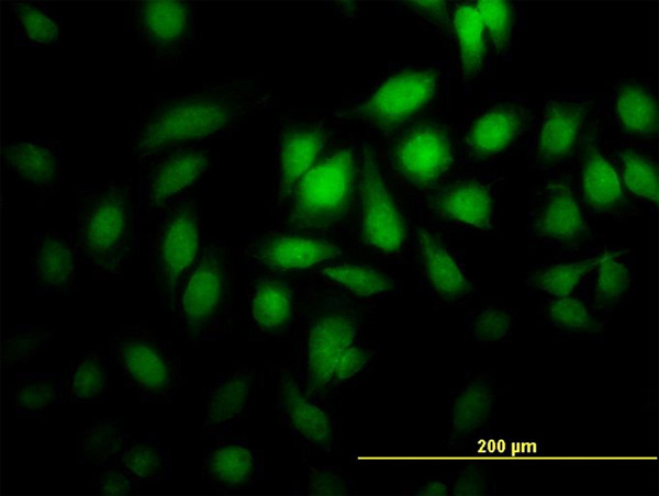 PGGT1B Antibody in Immunocytochemistry (ICC/IF)