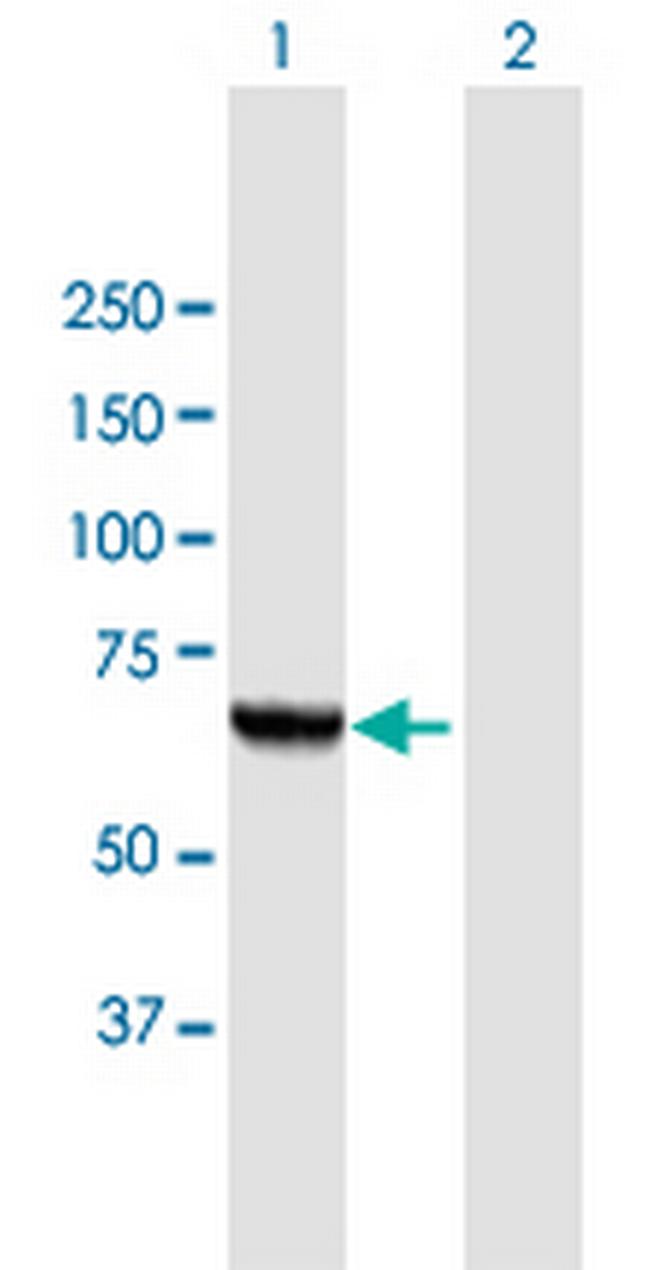 PGM3 Antibody in Western Blot (WB)
