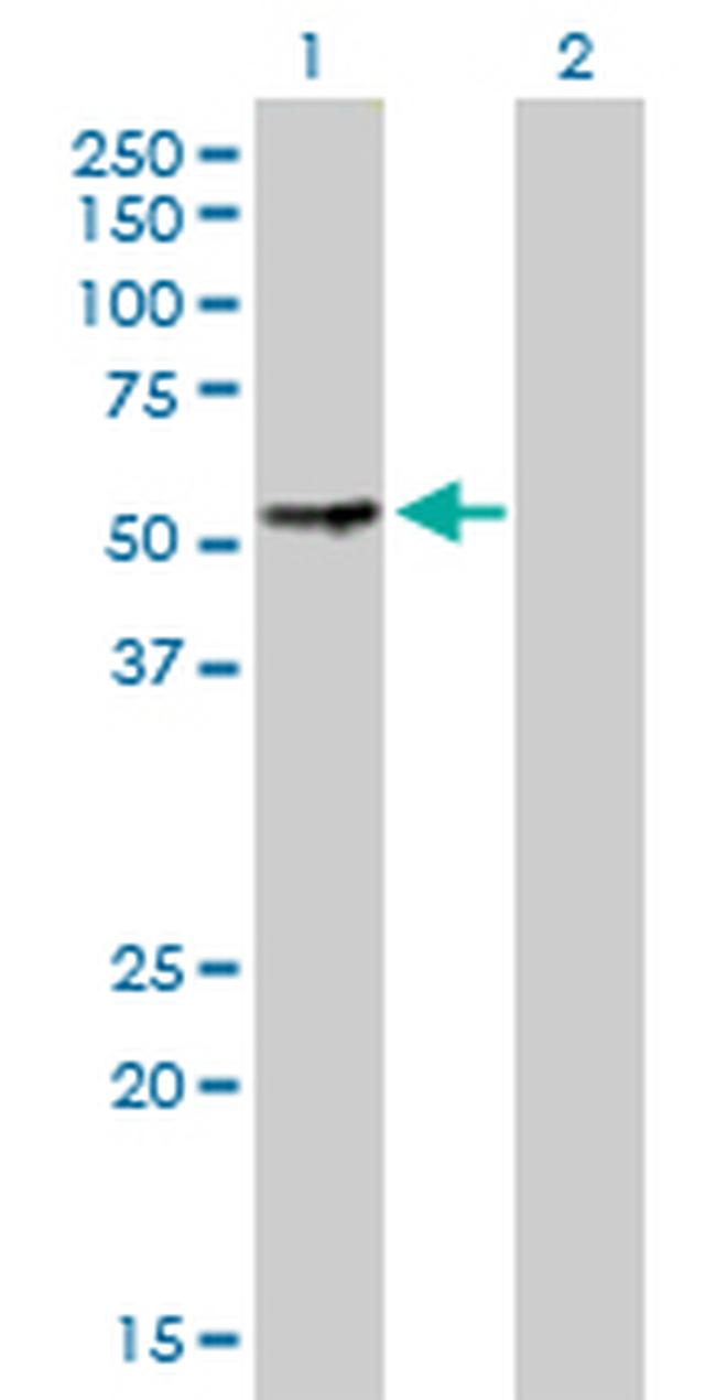 PGM3 Antibody in Western Blot (WB)