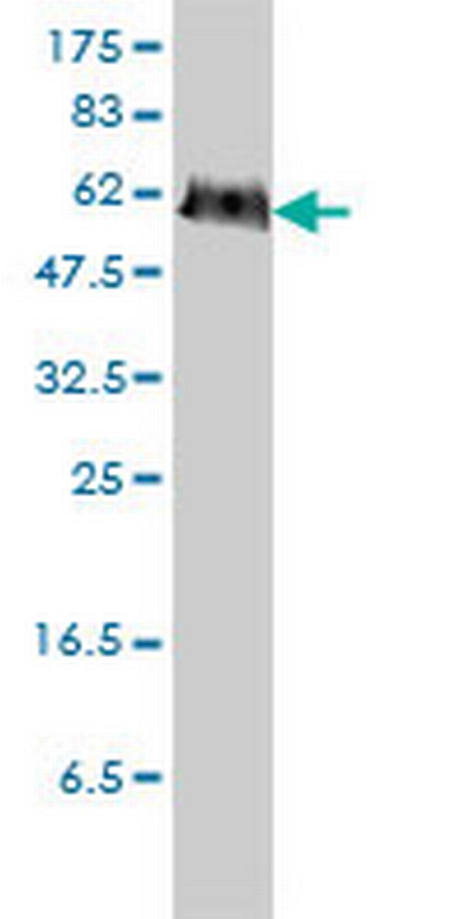 PGM3 Antibody in Western Blot (WB)