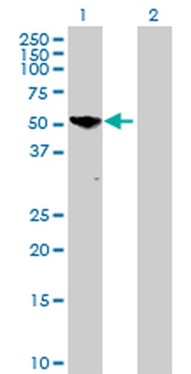 PGM5 Antibody in Western Blot (WB)