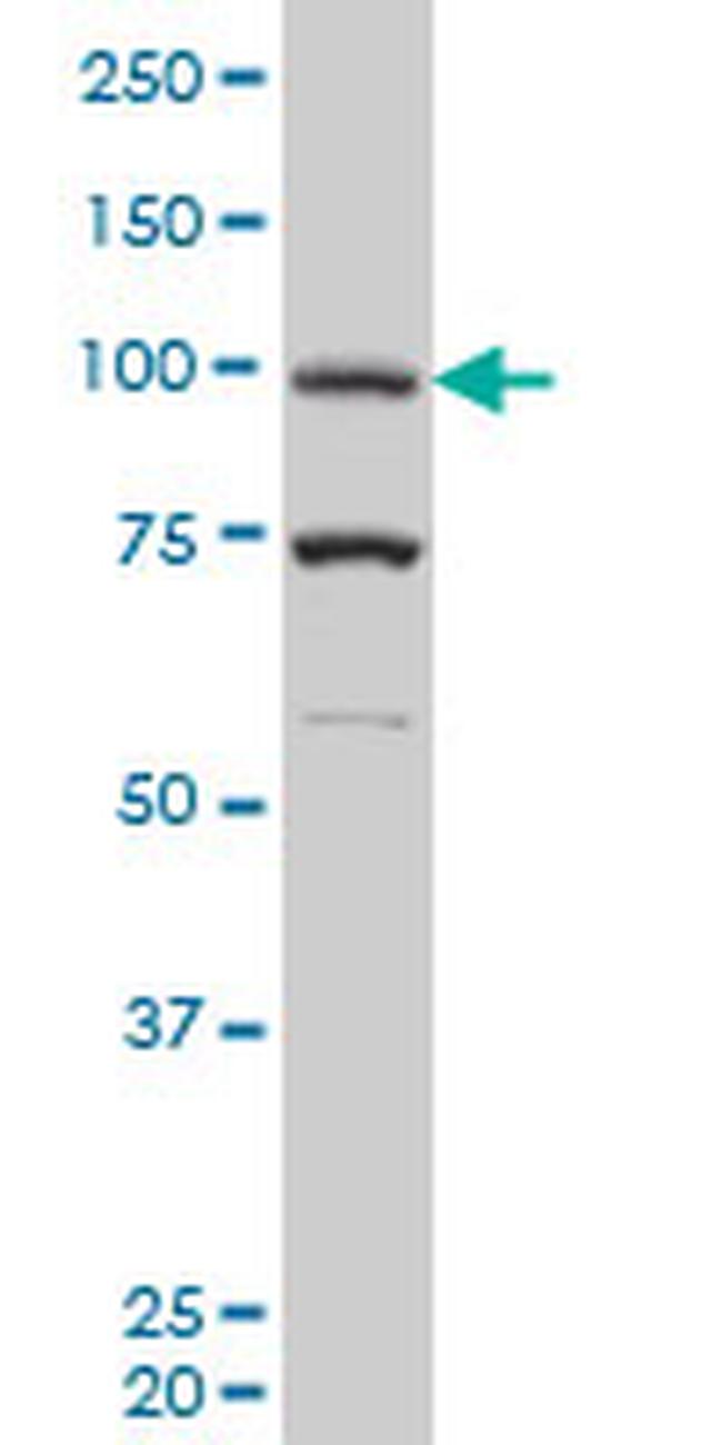PGR Antibody in Western Blot (WB)