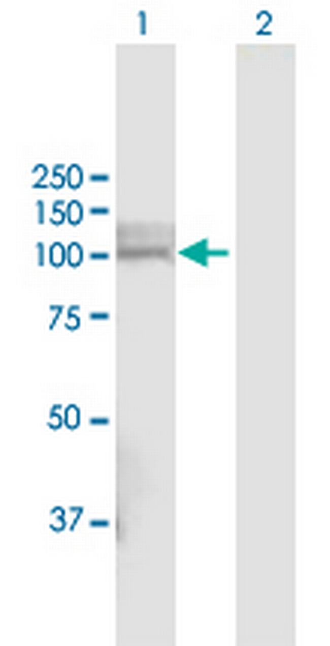 PHEX Antibody in Western Blot (WB)