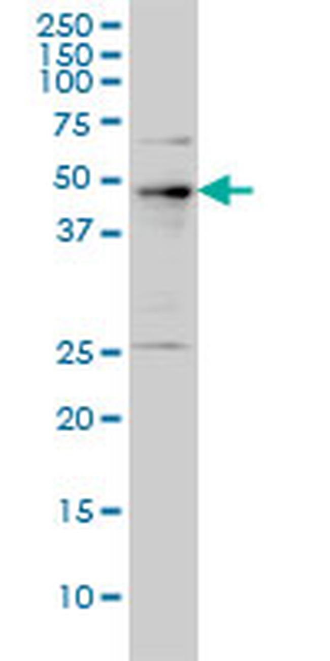 PHF1 Antibody in Western Blot (WB)