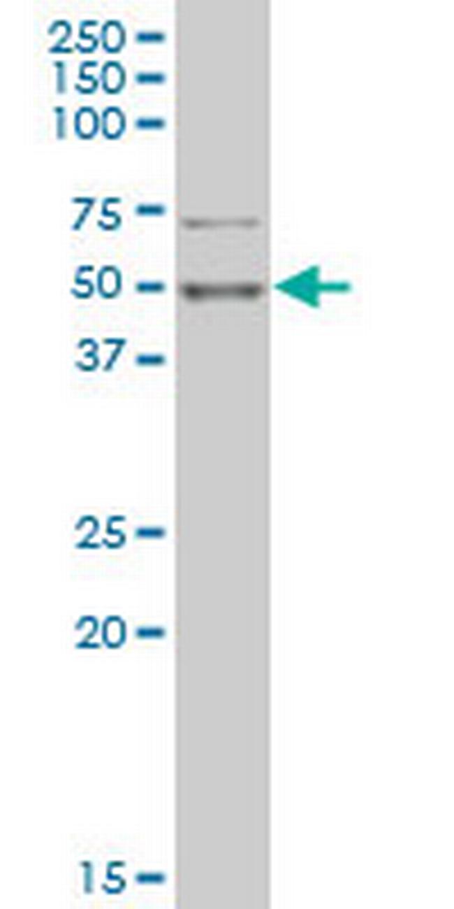 PHF1 Antibody in Western Blot (WB)