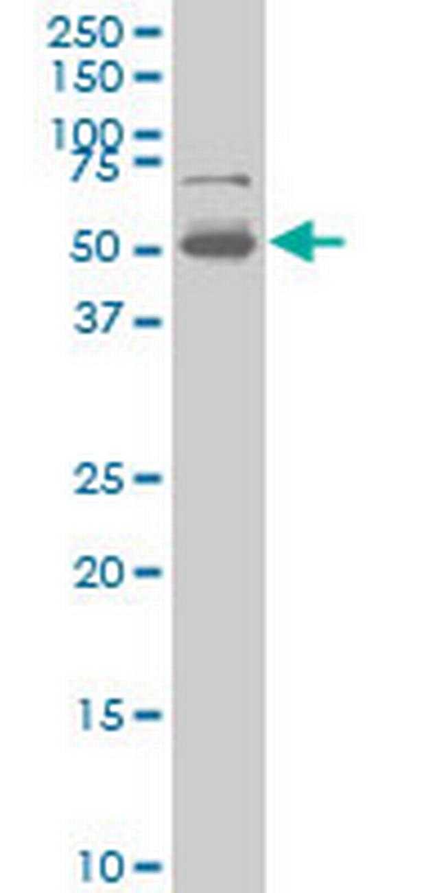 PHF1 Antibody in Western Blot (WB)