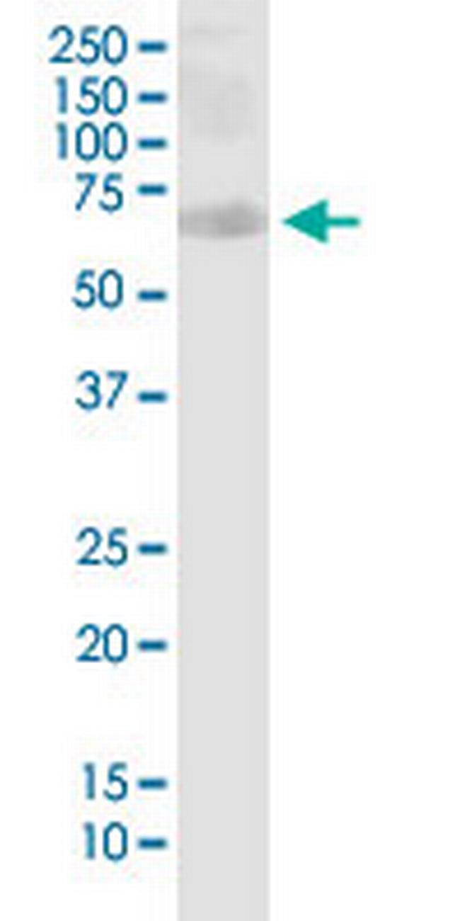 PHF1 Antibody in Western Blot (WB)