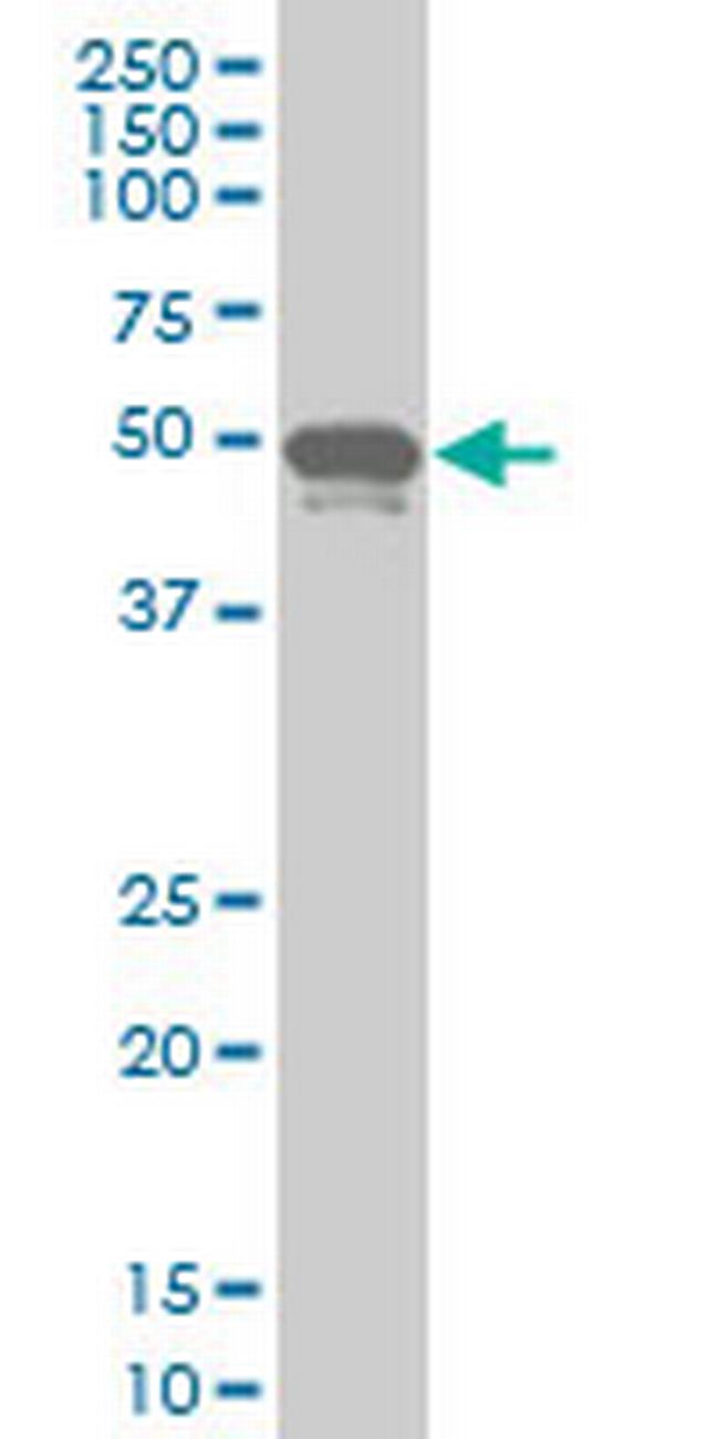 PHF1 Antibody in Western Blot (WB)