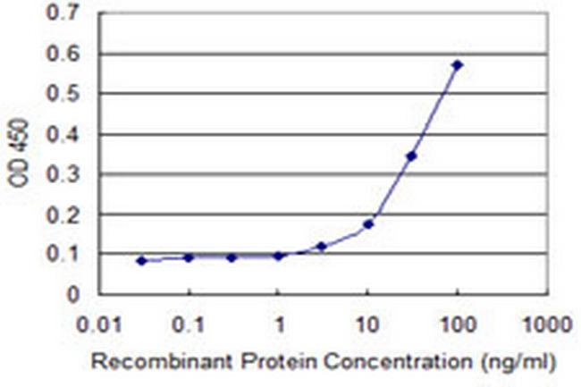 PHKG2 Antibody in ELISA (ELISA)