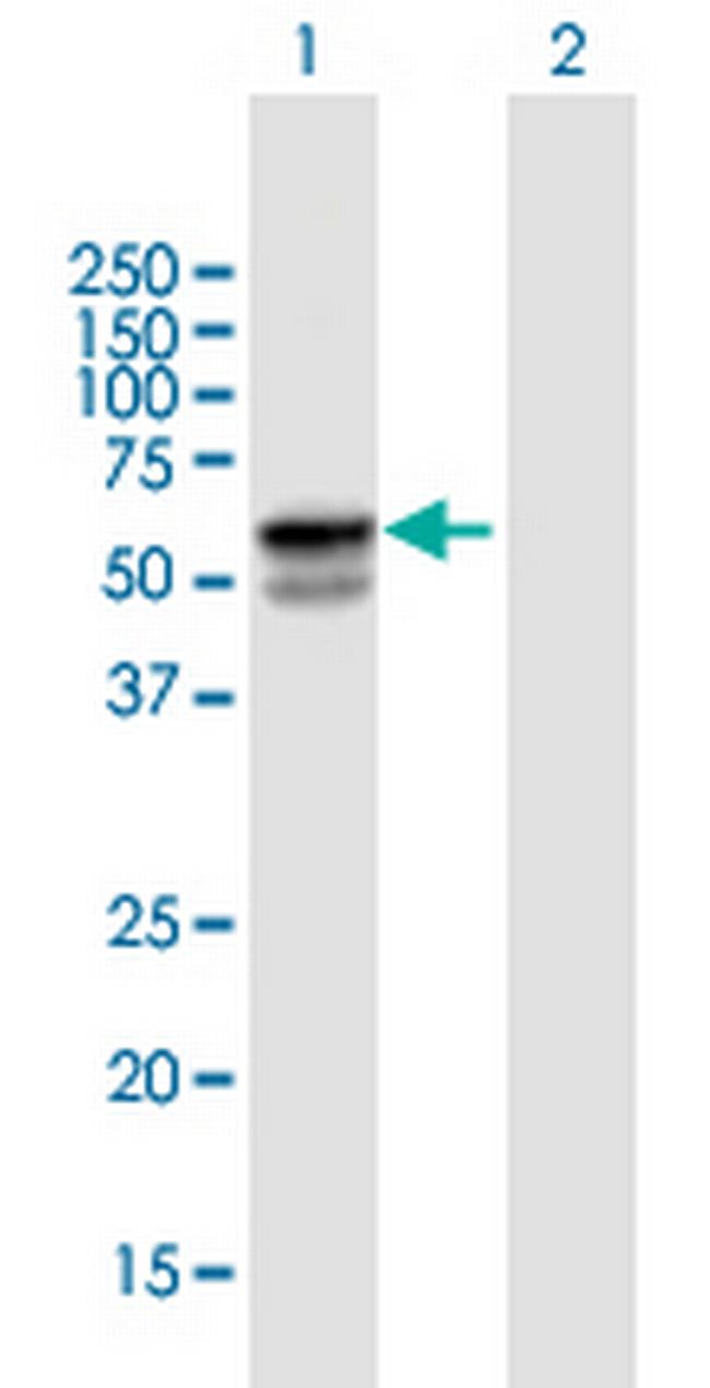 SERPINA1 Antibody in Western Blot (WB)