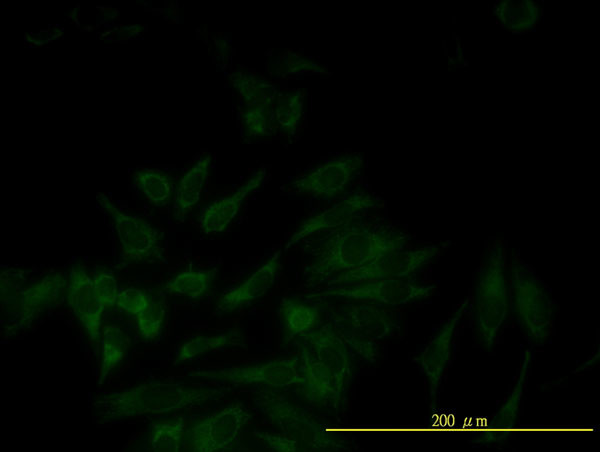 SERPINB5 Antibody in Immunocytochemistry (ICC/IF)