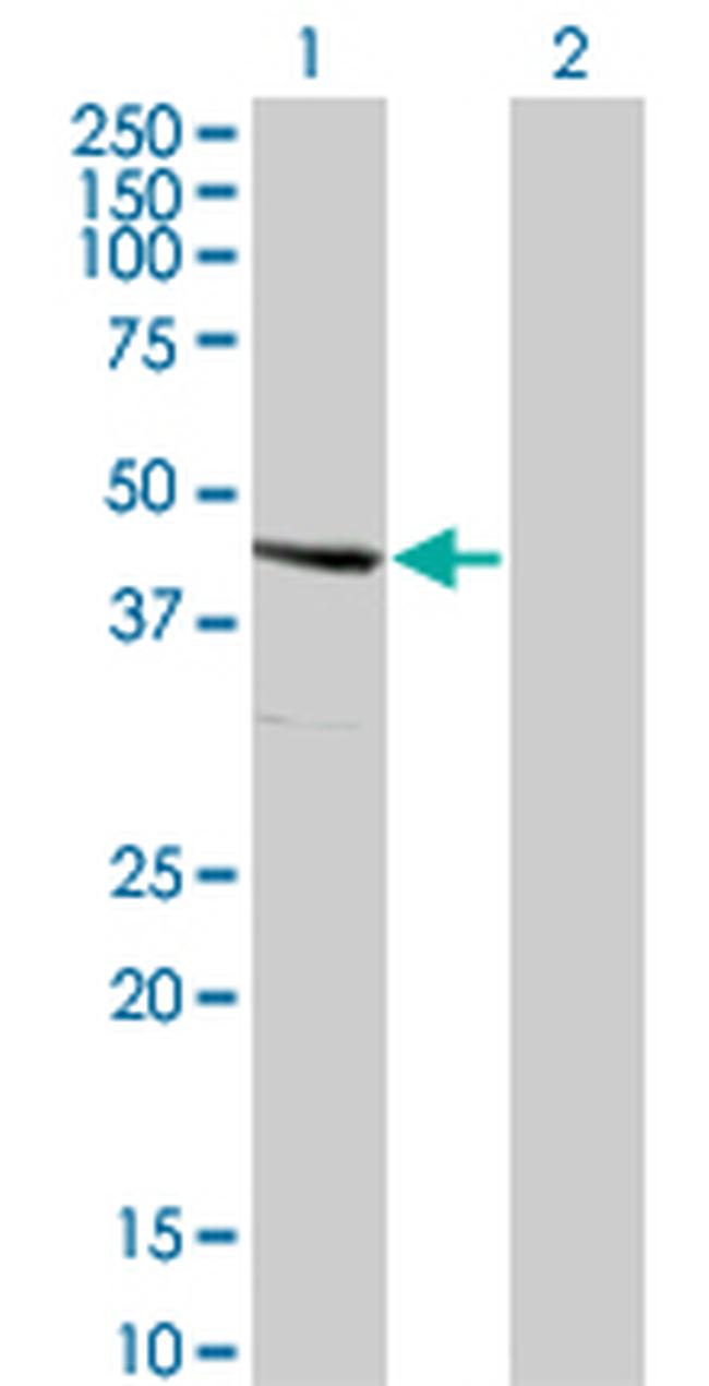 SERPINE2 Antibody in Western Blot (WB)