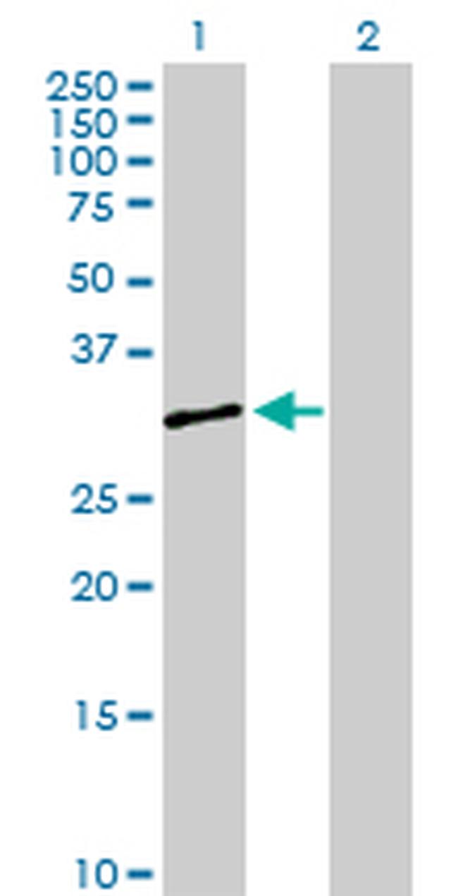 SERPINB8 Antibody in Western Blot (WB)