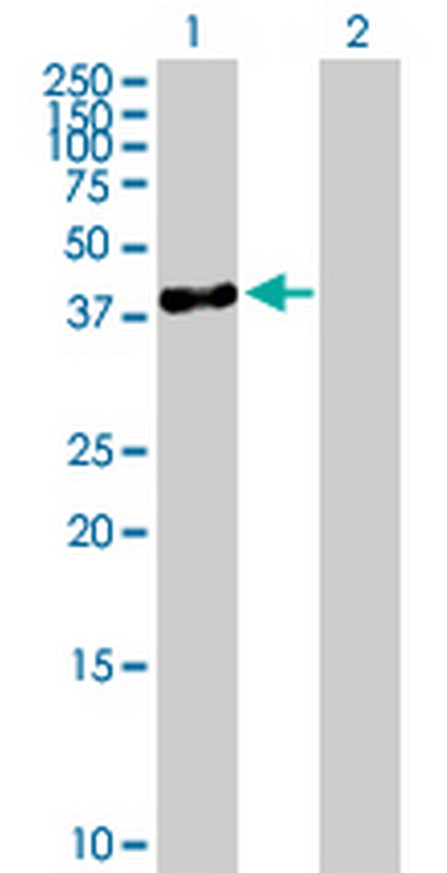 SERPINB10 Antibody in Western Blot (WB)