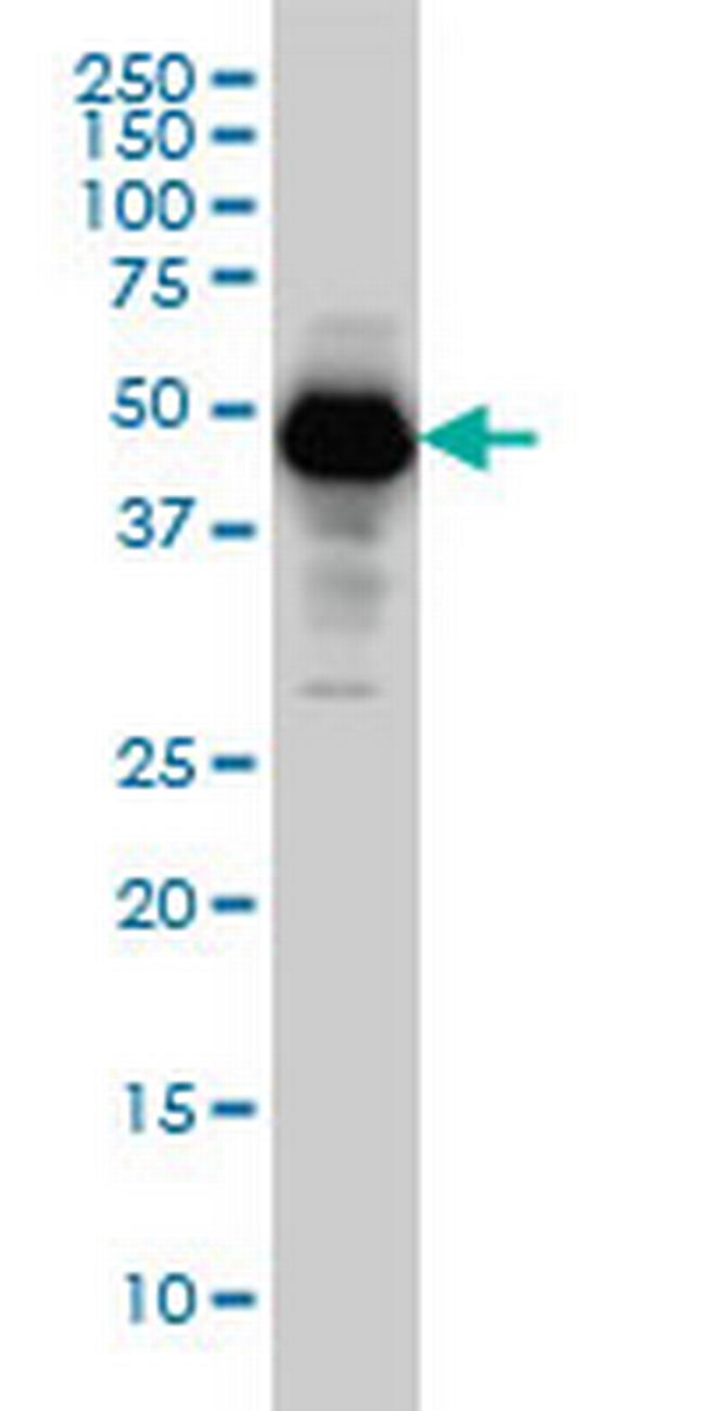 SERPINI1 Antibody in Western Blot (WB)