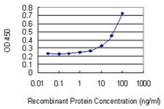 PIGR Antibody in ELISA (ELISA)