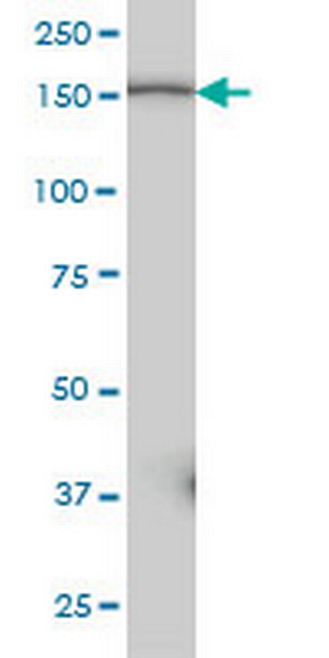 PIK3C2B Antibody in Western Blot (WB)