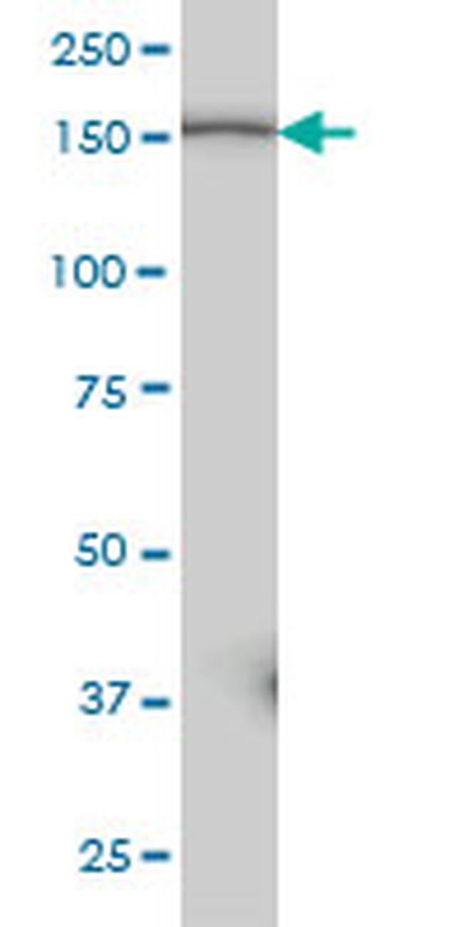 PIK3C2B Antibody in Western Blot (WB)