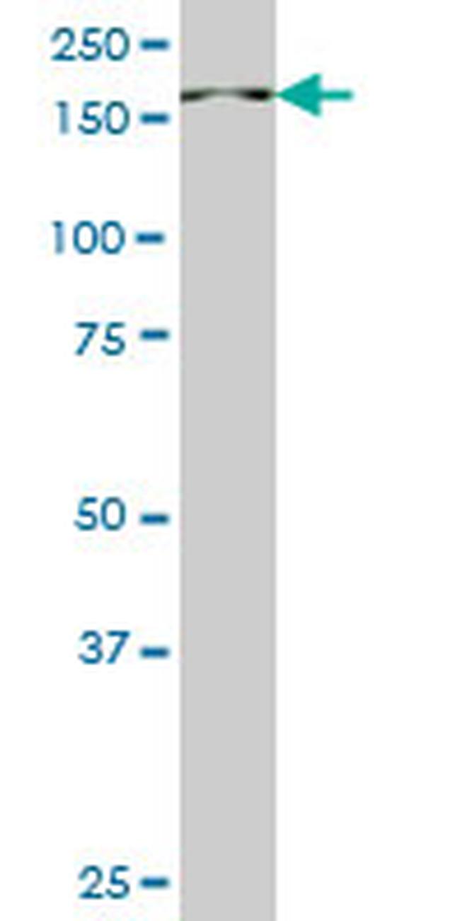 PIK3C2B Antibody in Western Blot (WB)
