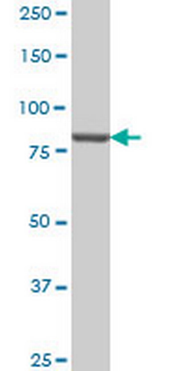 PIK3R1 Antibody in Western Blot (WB)