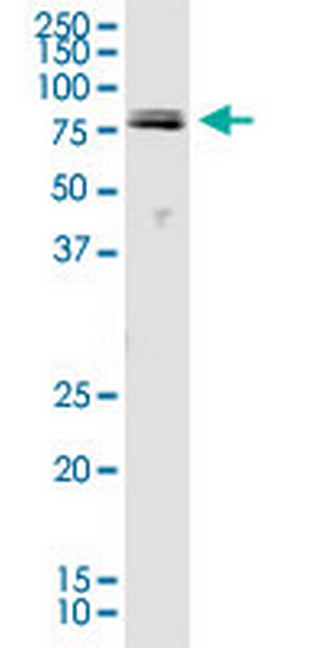 PIK3R1 Antibody in Western Blot (WB)