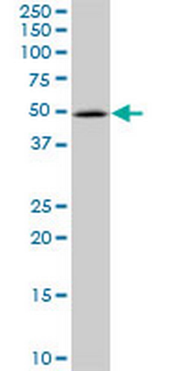 PIP5K2A Antibody in Western Blot (WB)