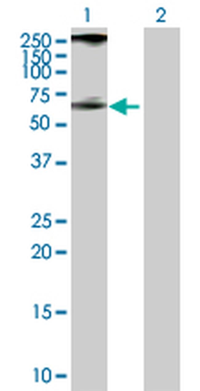 PIP4K2A Antibody in Western Blot (WB)