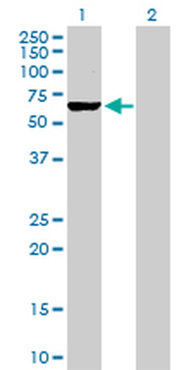 PKLR Antibody in Western Blot (WB)