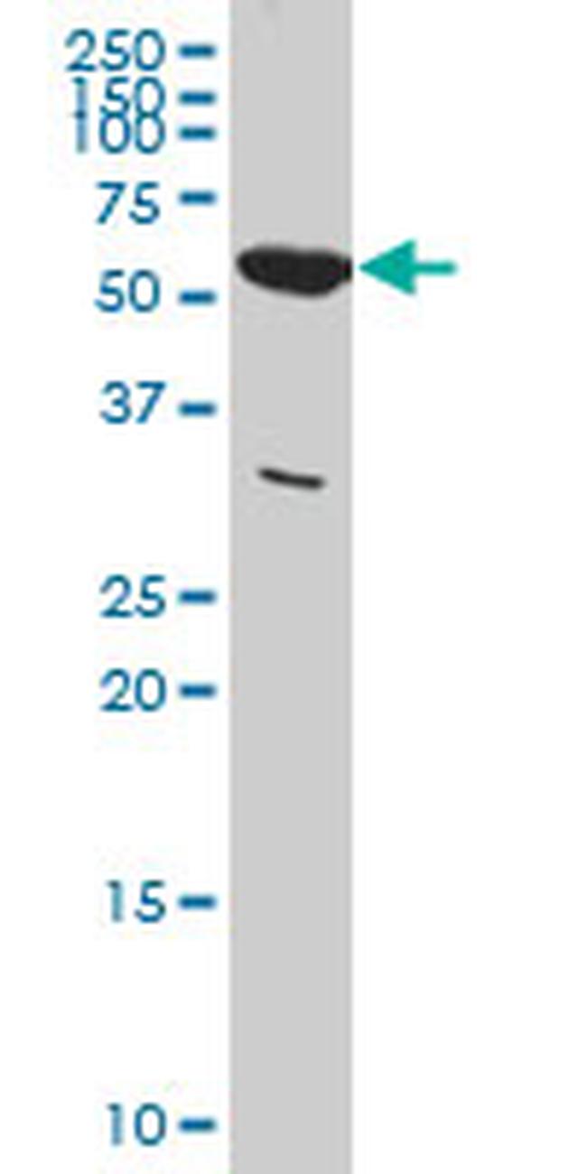 PKM2 Antibody in Western Blot (WB)