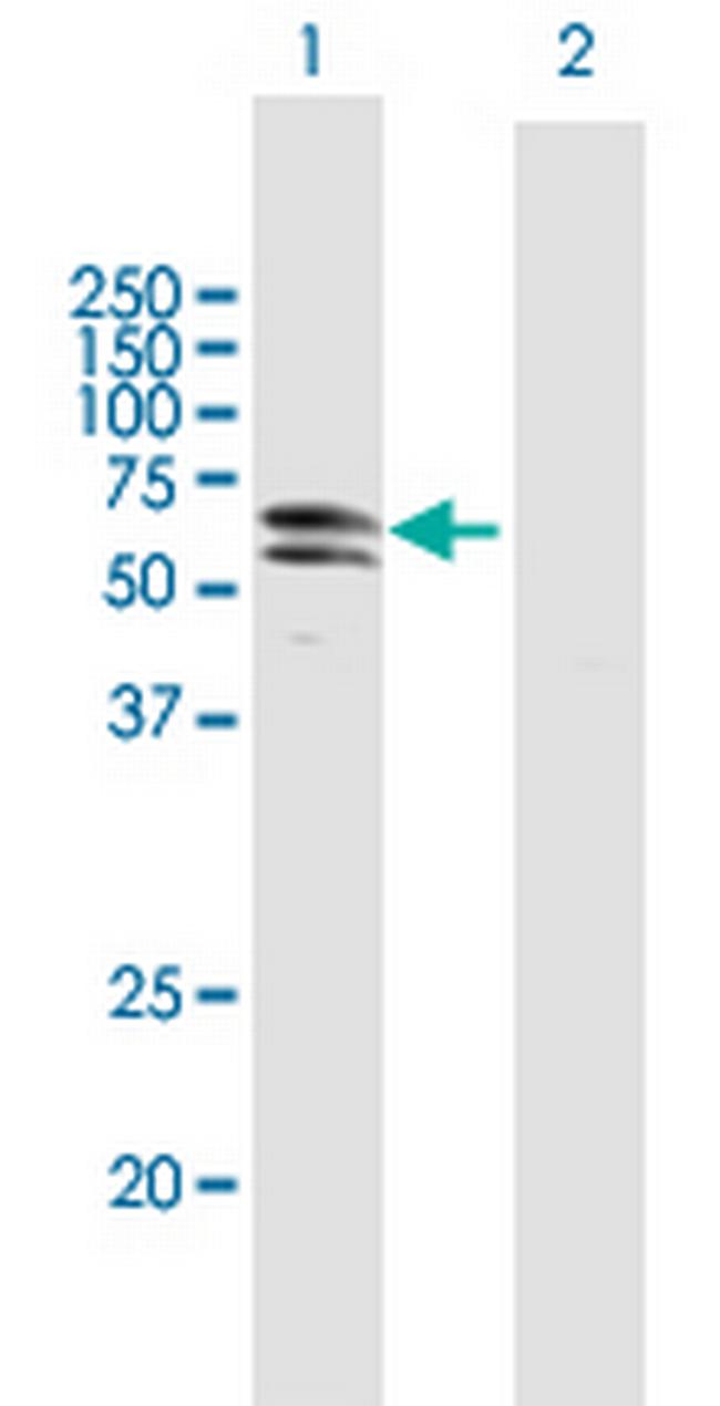 PKNOX1 Antibody in Western Blot (WB)