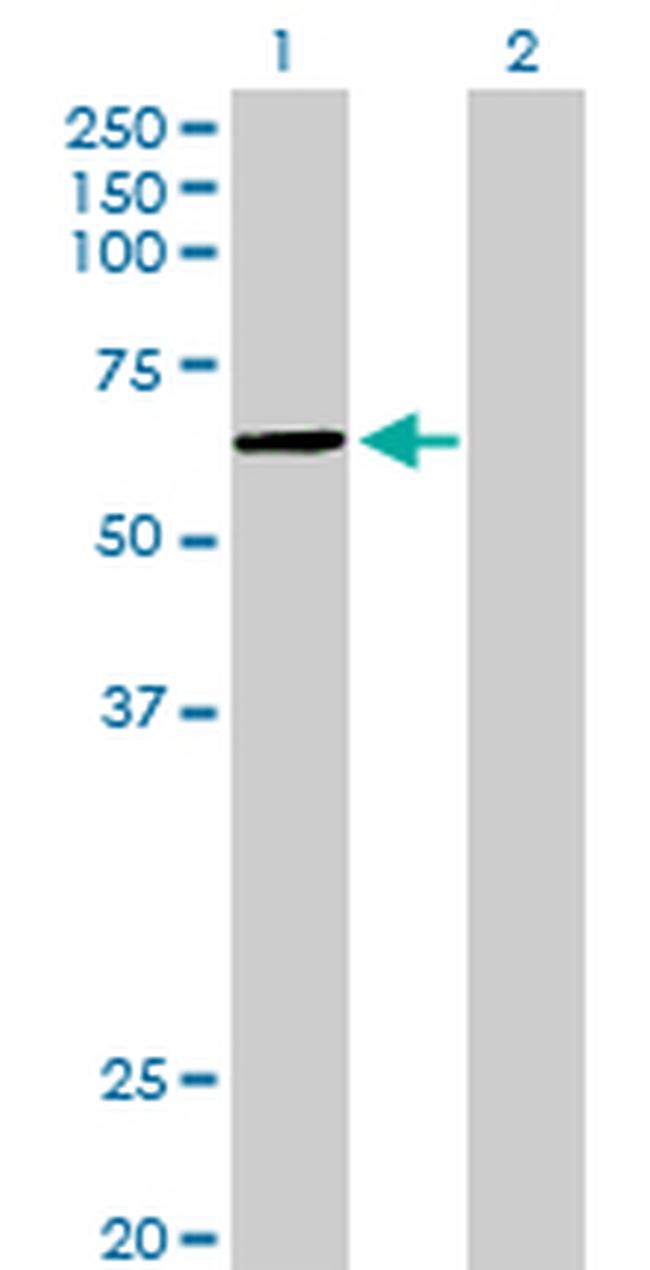 PKNOX1 Antibody in Western Blot (WB)