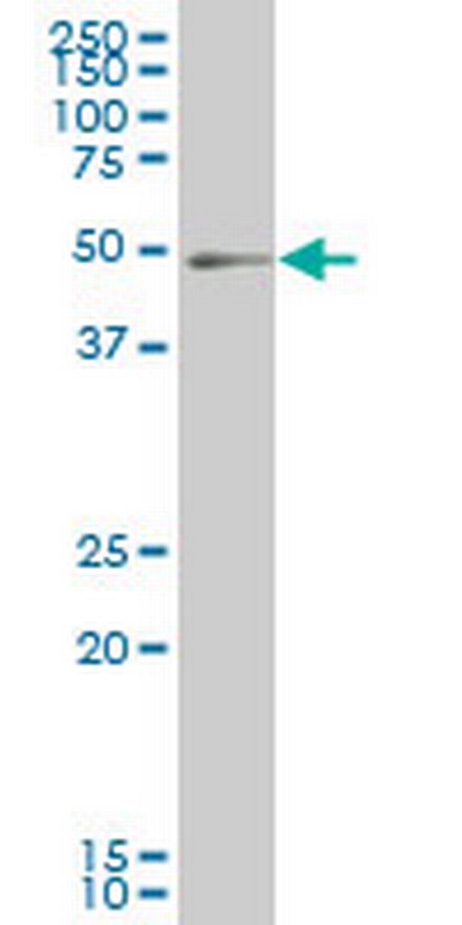 PKNOX1 Antibody in Western Blot (WB)