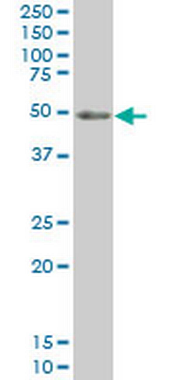 PKNOX1 Antibody in Western Blot (WB)