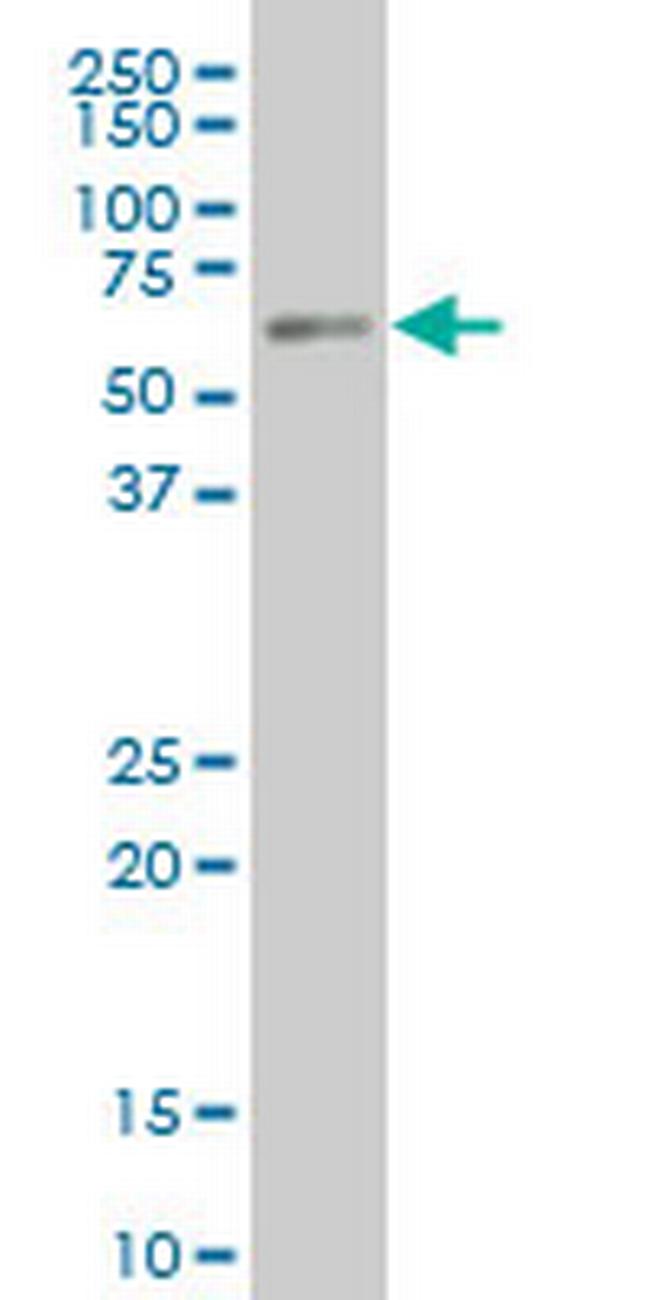 PKNOX1 Antibody in Western Blot (WB)
