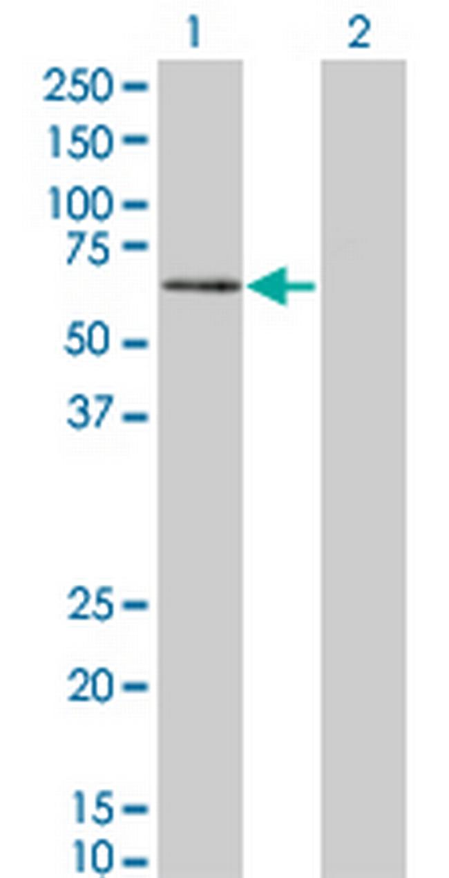PKNOX1 Antibody in Western Blot (WB)