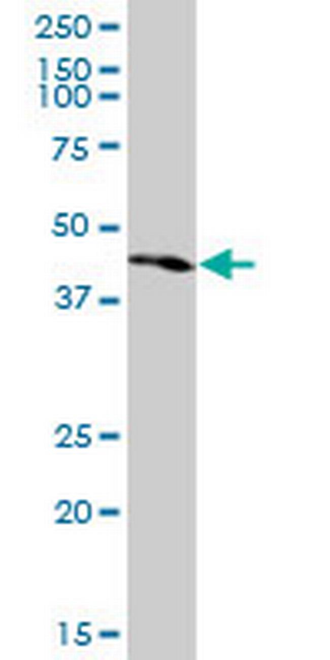 PKNOX1 Antibody in Western Blot (WB)