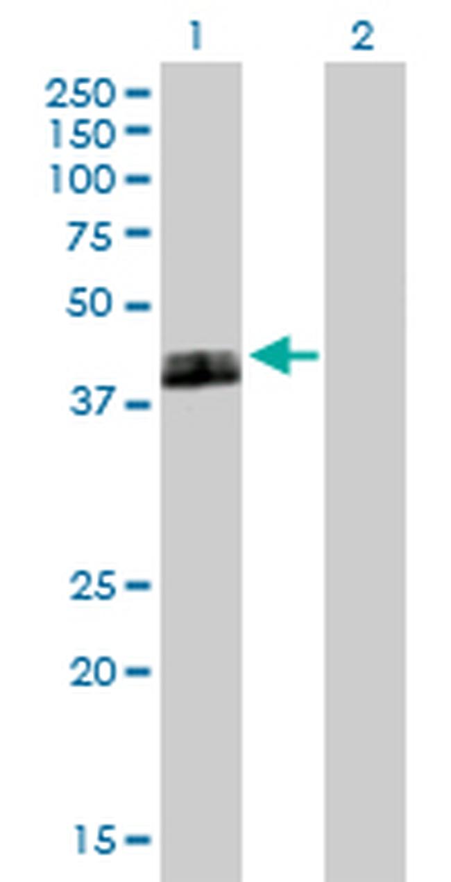 PLAUR Antibody in Western Blot (WB)
