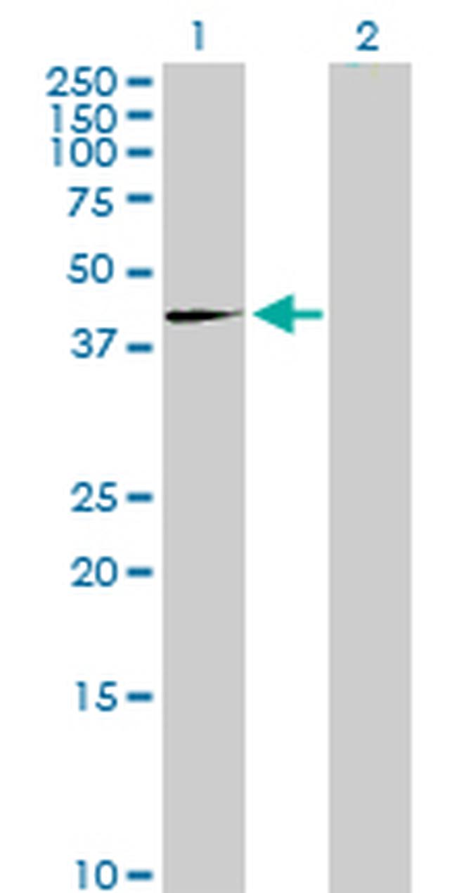 PLAUR Antibody in Western Blot (WB)