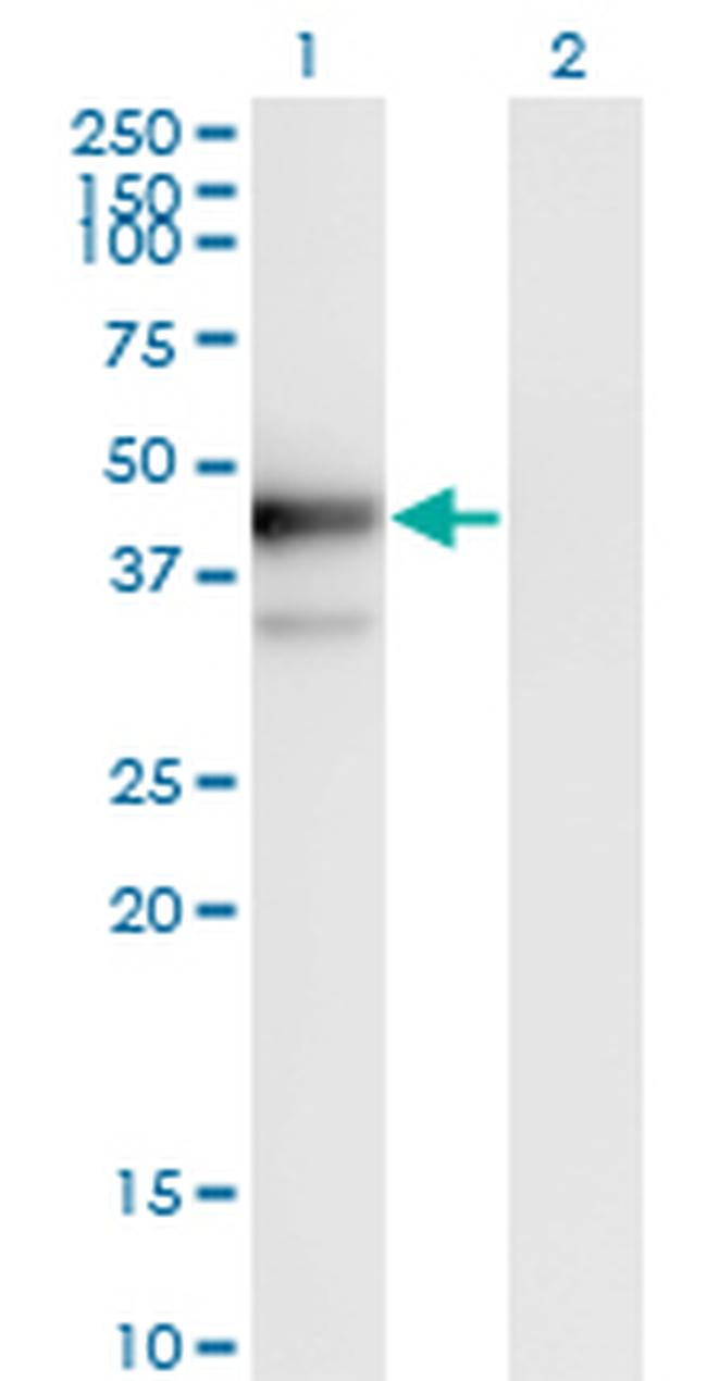 PLAUR Antibody in Western Blot (WB)