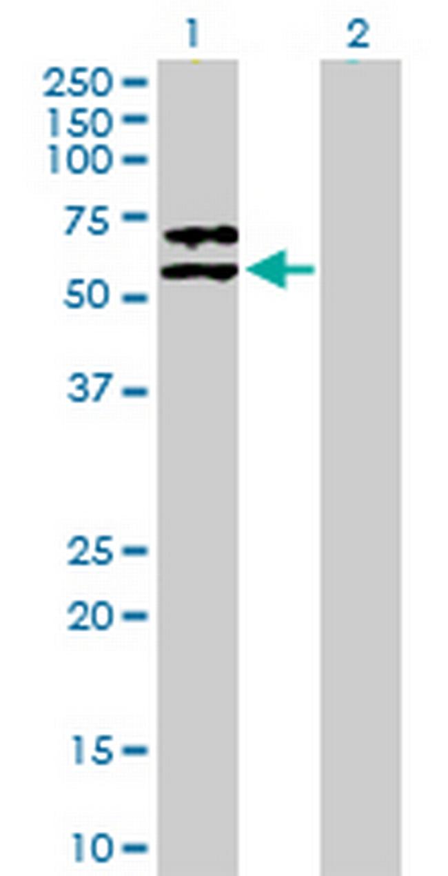 SERPINF2 Antibody in Western Blot (WB)