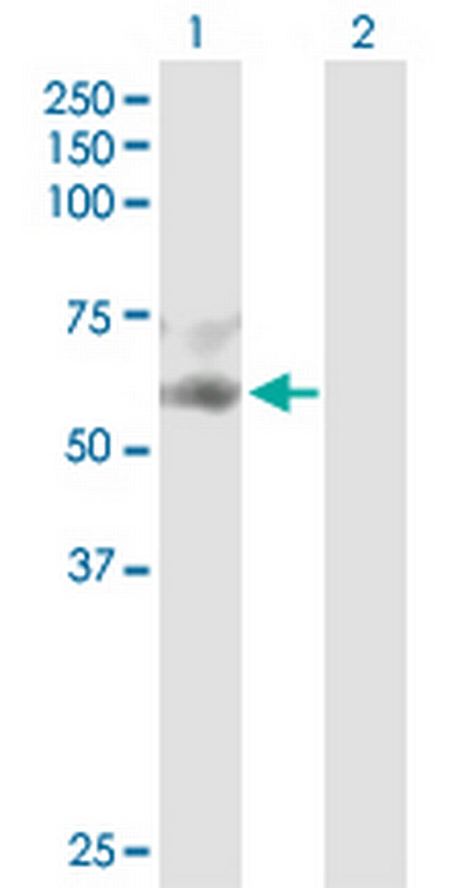 SERPINF2 Antibody in Western Blot (WB)
