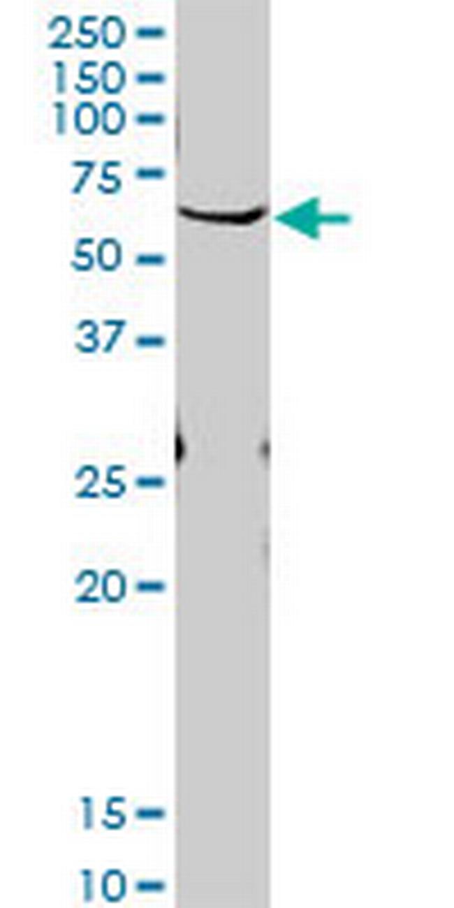 PLK1 Antibody in Western Blot (WB)