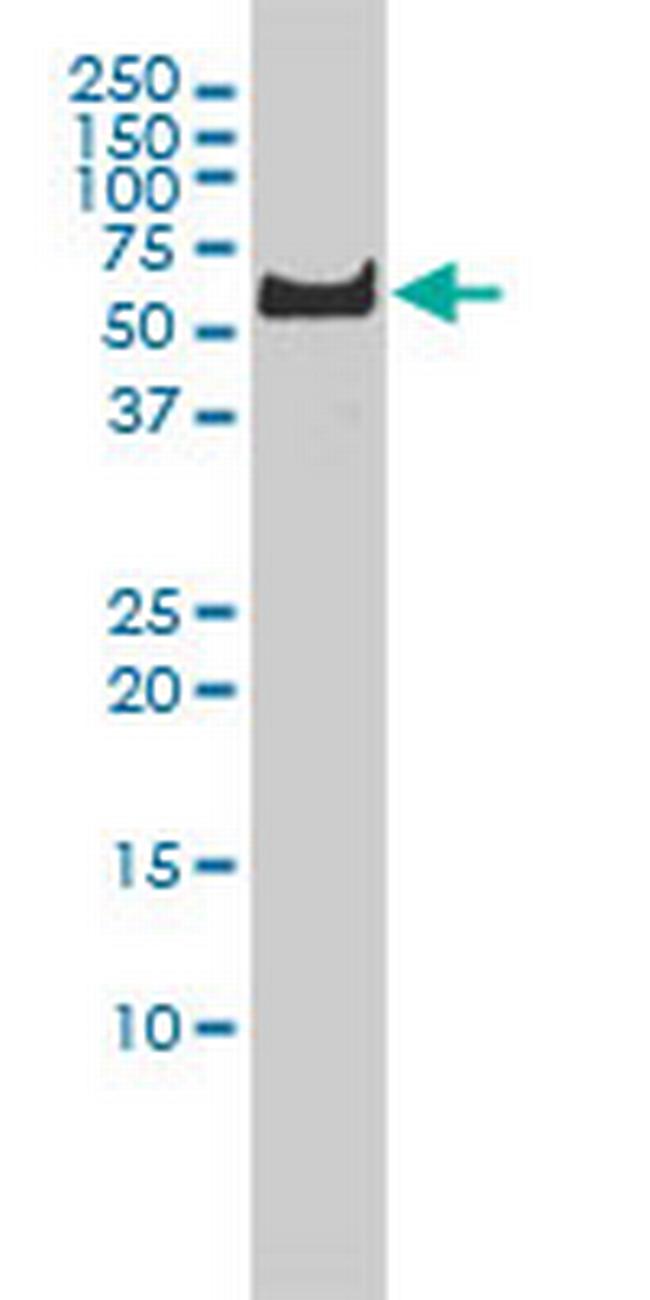 PLK1 Antibody in Western Blot (WB)