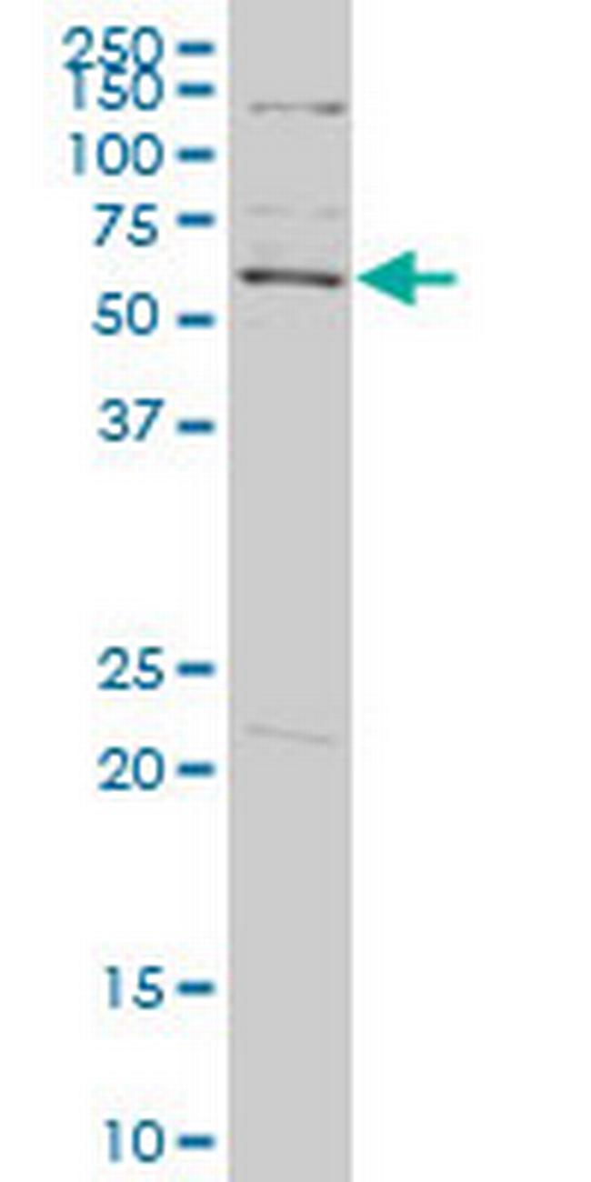 PLK1 Antibody in Western Blot (WB)