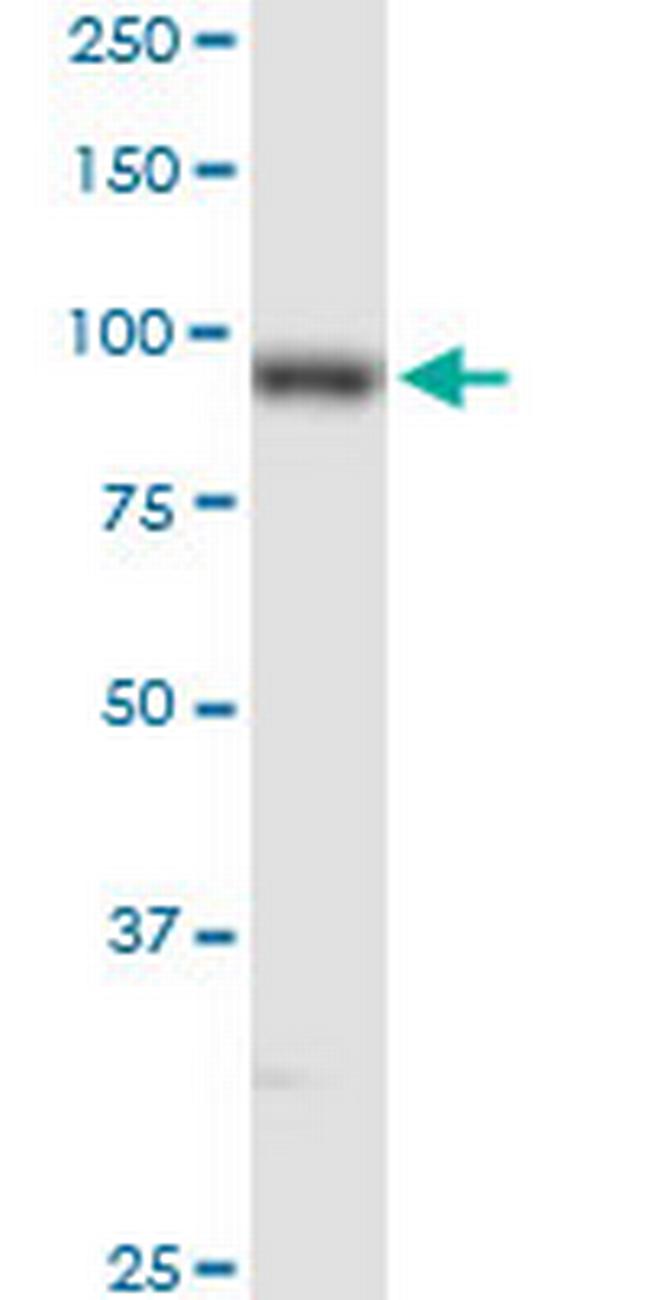 PLOD2 Antibody in Western Blot (WB)