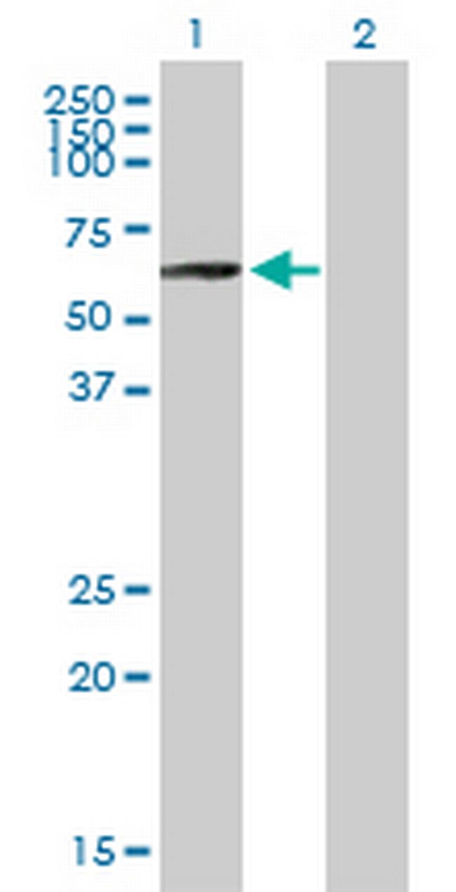 PLRG1 Antibody in Western Blot (WB)