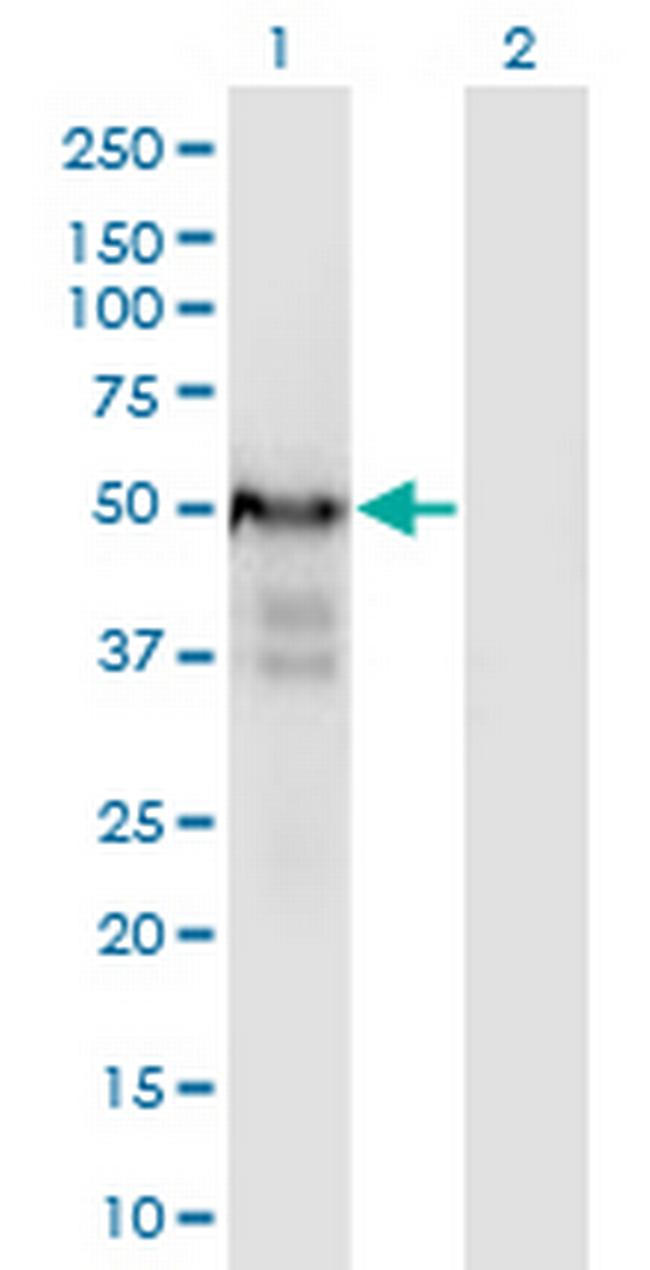 PLRG1 Antibody in Western Blot (WB)