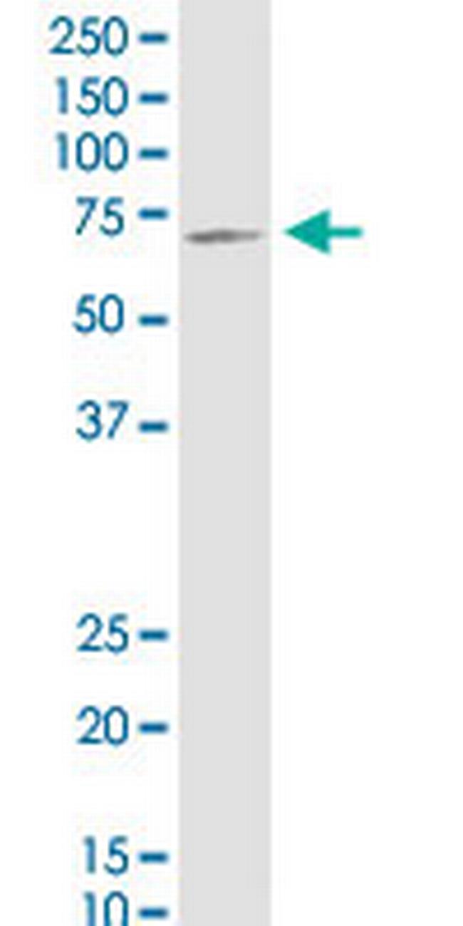 PLS3 Antibody in Western Blot (WB)